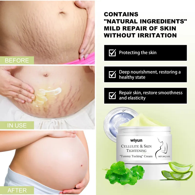 Pregnancy Scars Skin Repair Cream